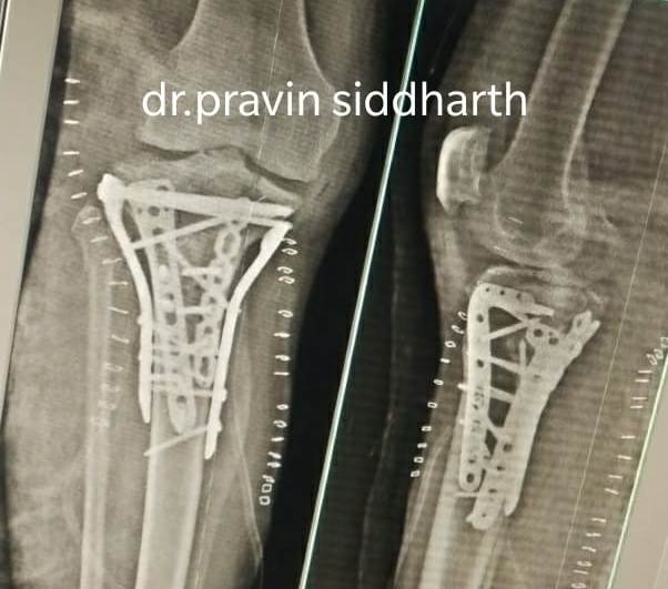 services of nirmala multispeciality hospital and trauma centre